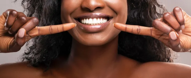 smiling women pointing her fingers to her teeth's