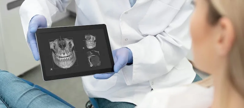 Dentist Showing Xrays Of A Jaw To His Patient